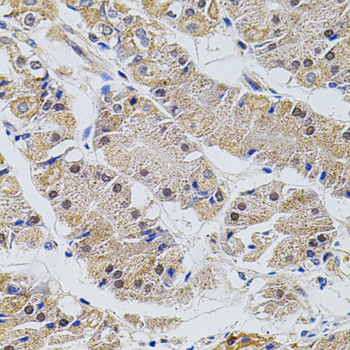Immunohistochemistry - TRMT2A Polyclonal Antibody 
