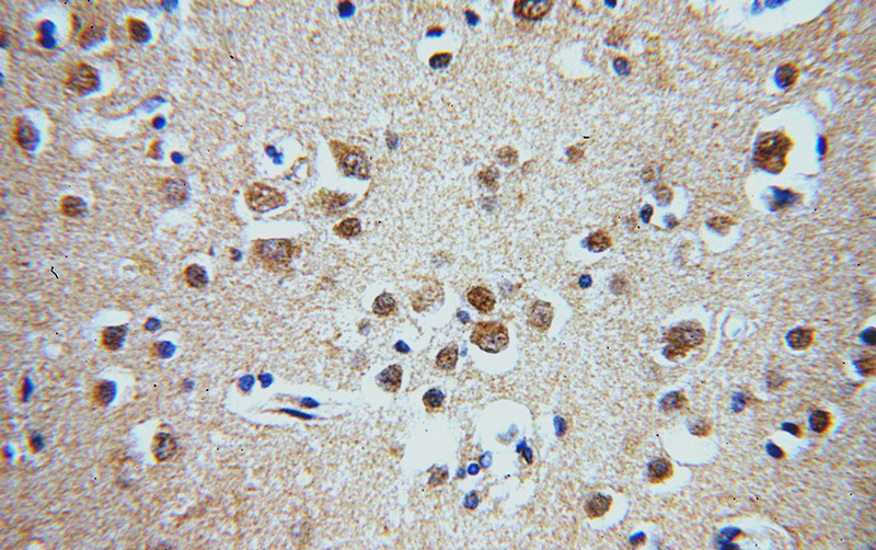 Immunohistochemical of paraffin-embedded human brain using Catalog No:116933(ZCCHC11 antibody) at dilution of 1:50 (under 40x lens)
