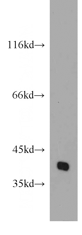 mouse brain tissue were subjected to SDS PAGE followed by western blot with Catalog No:114073(POU4F2 antibody) at dilution of 1:500