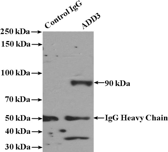 IP Result of anti-ADD3 (IP:Catalog No:110856, 4ug; Detection:Catalog No:110856 1:500) with NIH/3T3 cells lysate 3200ug.