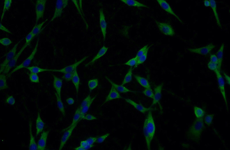 Immunofluorescent analysis of C6 cells using Catalog No:113181(Nicastrin Antibody) at dilution of 1:25 and Alexa Fluor 488-congugated AffiniPure Goat Anti-Rabbit IgG(H+L)
