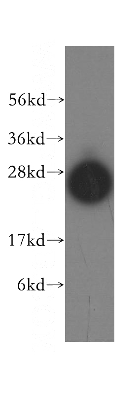 human heart tissue were subjected to SDS PAGE followed by western blot with Catalog No:115801(STX8 antibody) at dilution of 1:500