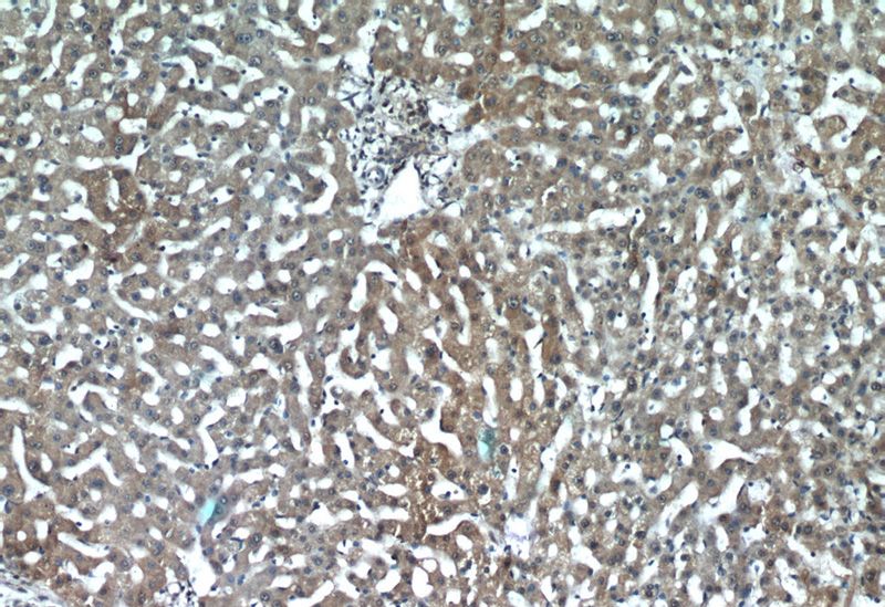 Immunohistochemistry of paraffin-embedded human liver tissue slide using Catalog No:111849(INSIG2 Antibody) at dilution of 1:50 (under 10x lens)