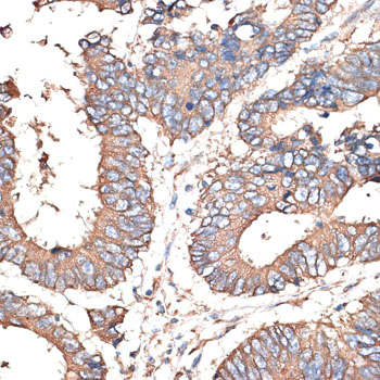 Immunohistochemistry - KRT81 Polyclonal Antibody 