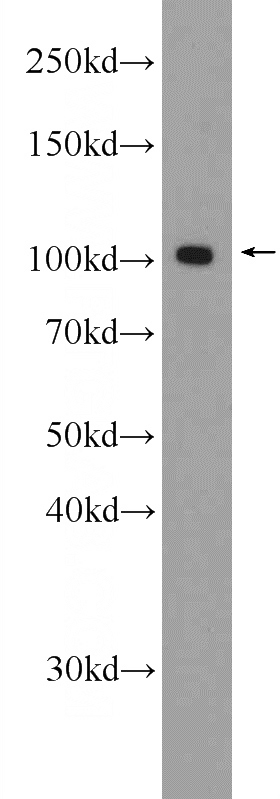 RAW 264.7 cells were subjected to SDS PAGE followed by western blot with Catalog No:115537(SPAG9 Antibody) at dilution of 1:1000