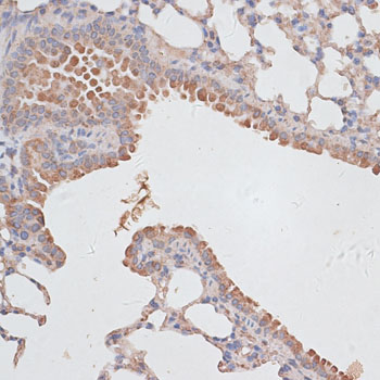 Immunohistochemistry - KCNK1 Polyclonal Antibody 