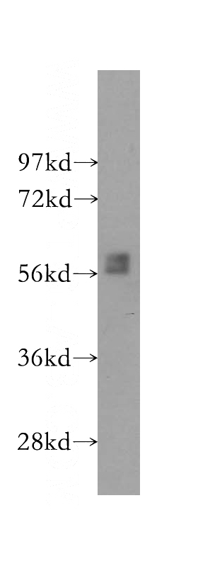 SH-SY5Y cells were subjected to SDS PAGE followed by western blot with Catalog No:117185(BLK antibody) at dilution of 1:500