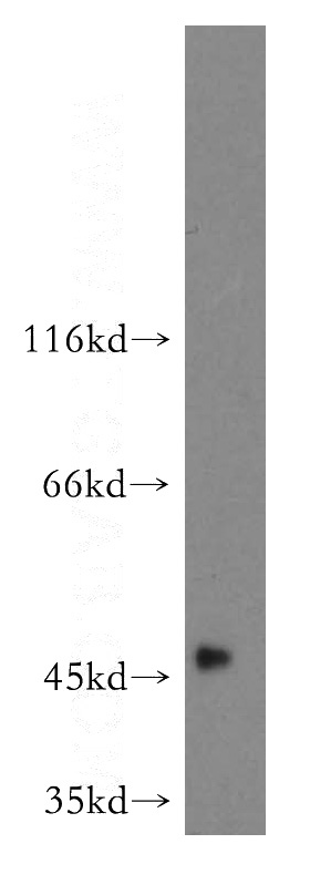 human liver tissue were subjected to SDS PAGE followed by western blot with Catalog No:110853(GALT antibody) at dilution of 1:500