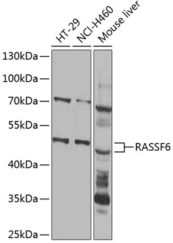 Western blot - RASSF6 Polyclonal Antibody 