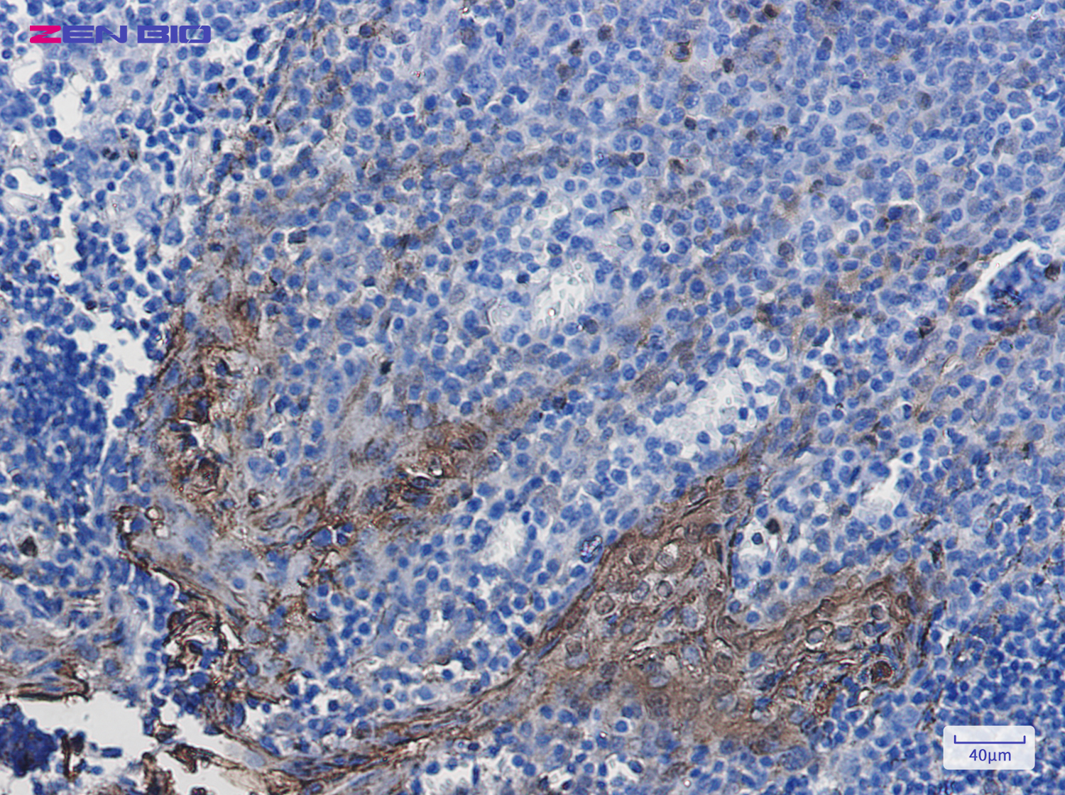Immunohistochemistry of Annexin A1 in paraffin-embedded Human tonsil using Annexin A1 Rabbit pAb at dilution 1/50