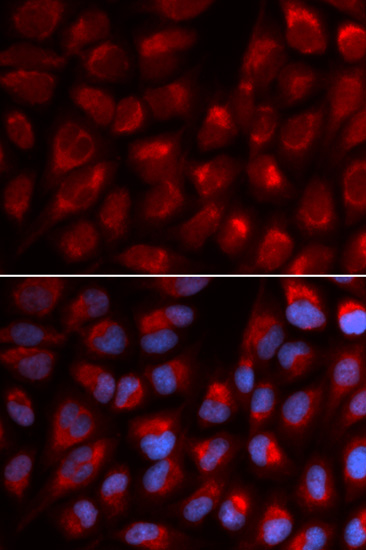 Immunofluorescence - EPB41 Polyclonal Antibody 
