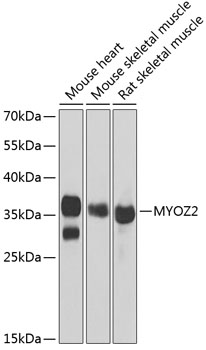 Western blot - MYOZ2 Polyclonal Antibody 