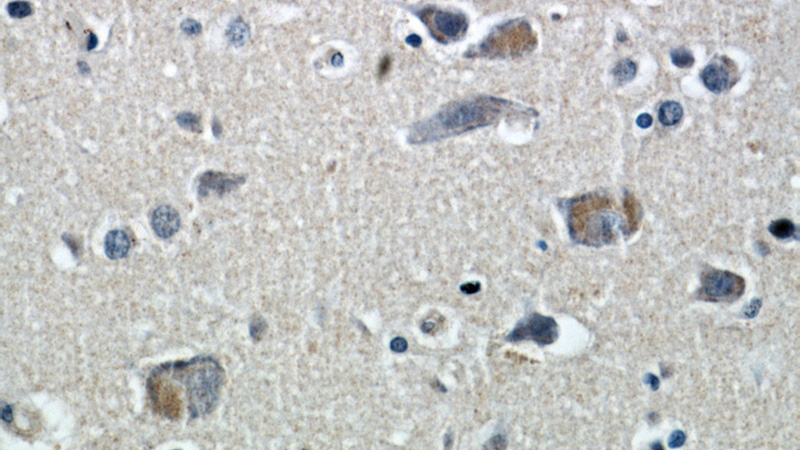 Immunohistochemical of paraffin-embedded human brain using Catalog No:112016(KIF5A antibody) at dilution of 1:100 (under 40x lens)