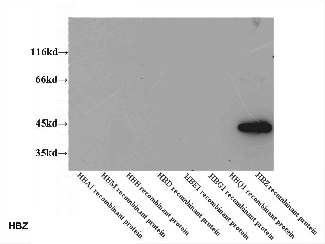 WB results of Catalog No:111277 (HBZ antibody) at dilution of 1:2000.