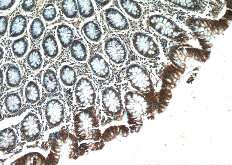 Immunohistochemistry of paraffin-embedded human colon tissue slide using Catalog No:113343(OPHN1 Antibody) at dilution of 1:50 (under 10x lens)