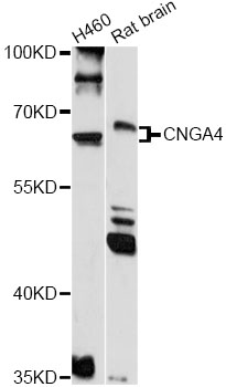 Western blot - CNGA4 Polyclonal Antibody 