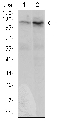 Fig3: Western blot analysis of DIS3L2 on Hela (1) and HepG2 (2) cell lysate using anti-DIS3L2 antibody at 1/1,000 dilution.