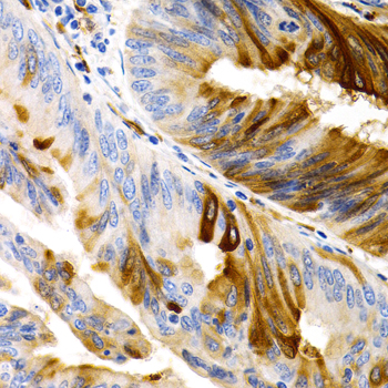 Immunohistochemistry - TFF1 Polyclonal Antibody 