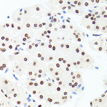 Immunohistochemistry - Histone H1.0 Polyclonal Antibody 