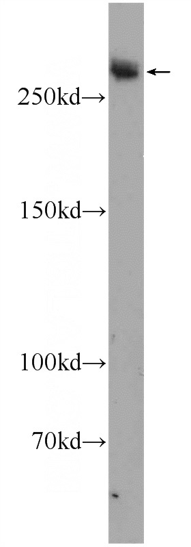 mouse heart tissue were subjected to SDS PAGE followed by western blot with Catalog No:109899(DSP Antibody) at dilution of 1:1000