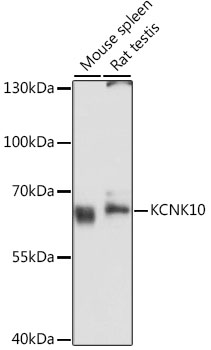 Western blot - KCNK10 Polyclonal Antibody 