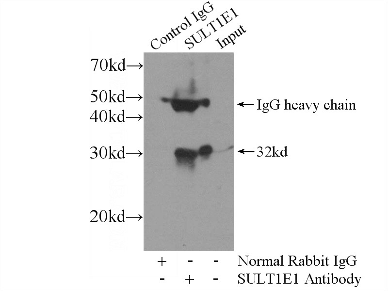 IP Result of anti-SULT1E1 (IP:Catalog No:115830, 4ug; Detection:Catalog No:115830 1:400) with mouse liver tissue lysate 4000ug.