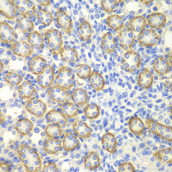Immunohistochemistry - SYT1 Polyclonal Antibody 