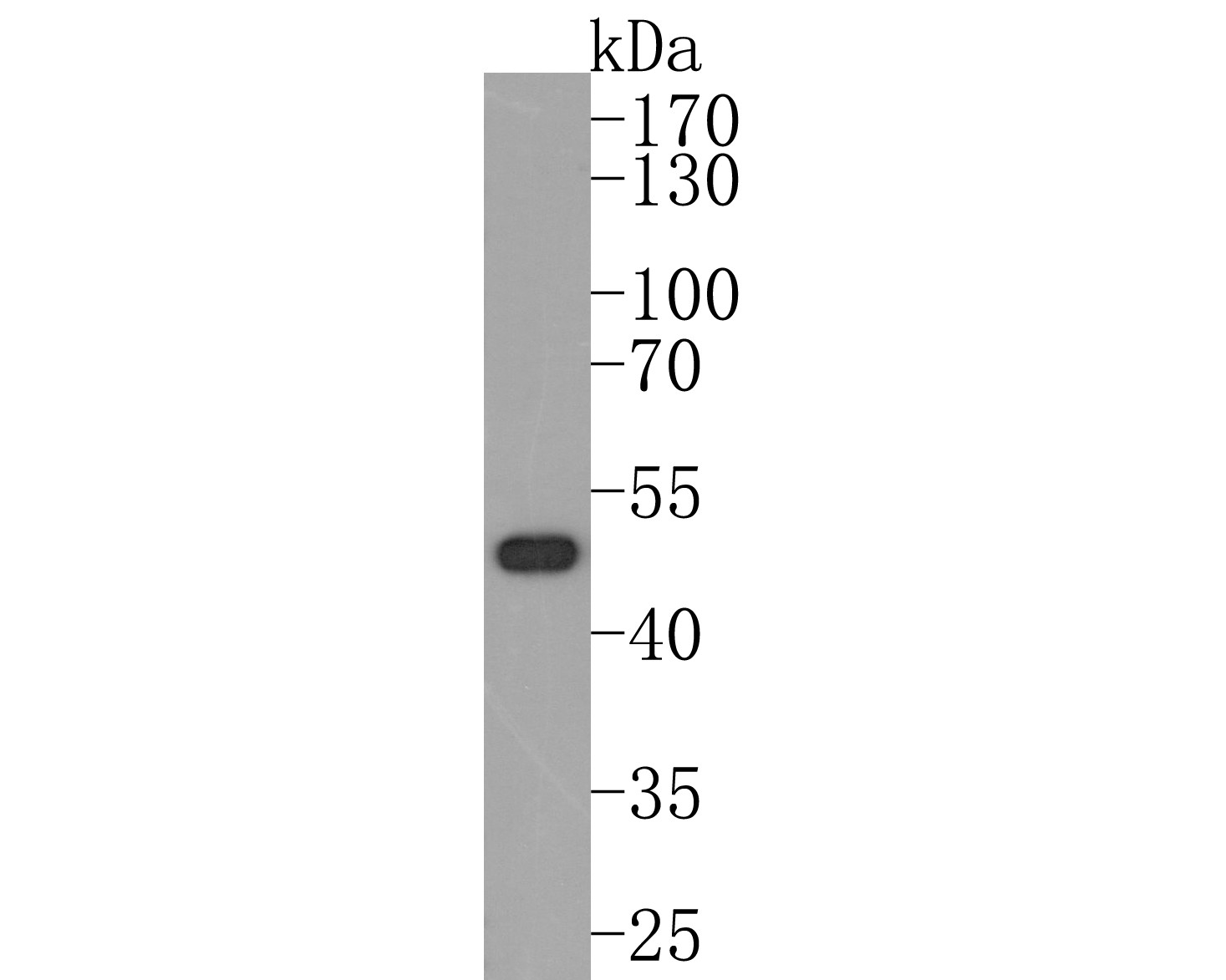 Fig1:; Western blot analysis of Nogo on Hela cell lysates. Proteins were transferred to a PVDF membrane and blocked with 5% BSA in PBS for 1 hour at room temperature. The primary antibody ( 1/500) was used in 5% BSA at room temperature for 2 hours. Goat Anti-Rabbit IgG - HRP Secondary Antibody (HA1001) at 1:200,000 dilution was used for 1 hour at room temperature.