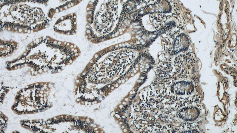 Immunohistochemical of paraffin-embedded human small intestine using Catalog No:115487(SOAT2 antibody) at dilution of 1:50 (under 10x lens)