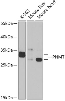 Western blot - PNMT Polyclonal Antibody 