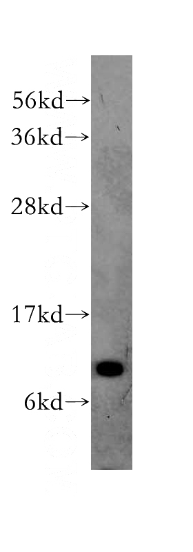 A549 cells were subjected to SDS PAGE followed by western blot with Catalog No:116136(TIMM9 antibody) at dilution of 1:300