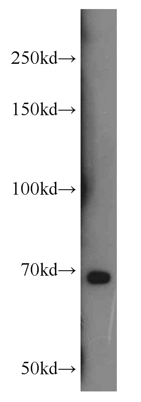 mouse brain tissue were subjected to SDS PAGE followed by western blot with Catalog No:113370(NUMB antibody) at dilution of 1:300