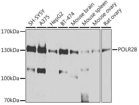 Western blot - POLR2B Polyclonal Antibody 