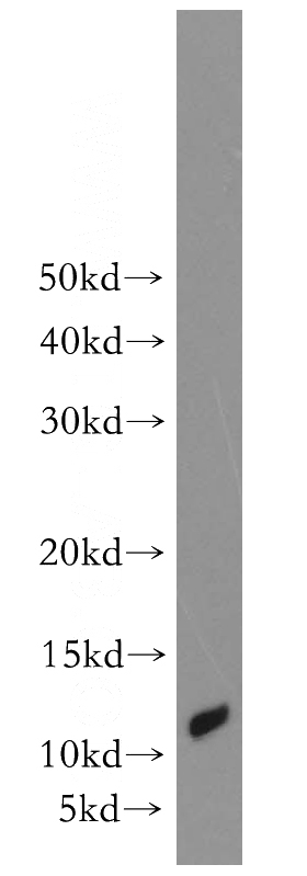 mouse skeletal muscle tissue were subjected to SDS PAGE followed by western blot with Catalog No:107758(ACYP2 antibody) at dilution of 1:500
