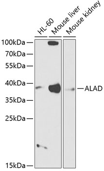 Western blot - ALAD Polyclonal Antibody 