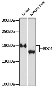 Western blot - EDC4 Polyclonal Antibody 