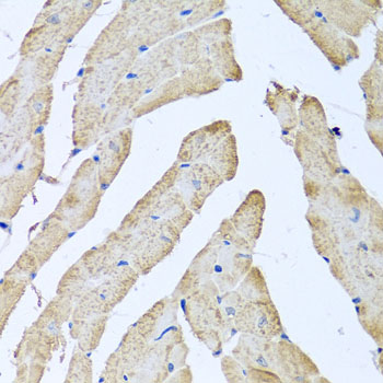 Immunohistochemistry - ATAD3B Polyclonal Antibody 