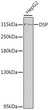 Western blot - DSP Polyclonal Antibody 