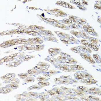 Immunohistochemistry - IER3 Polyclonal Antibody 