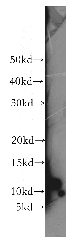 human kidney tissue were subjected to SDS PAGE followed by western blot with Catalog No:112799(MRAP antibody) at dilution of 1:300