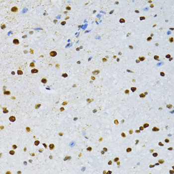 Immunohistochemistry - SNRNP70 Polyclonal Antibody 