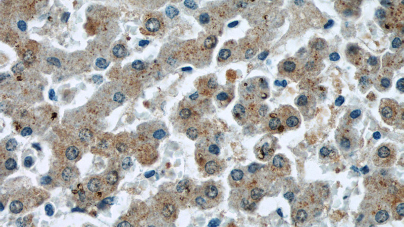 Immunohistochemical of paraffin-embedded human liver using Catalog No:107340(NUTF2 antibody) at dilution of 1:100 (under 40x lens)