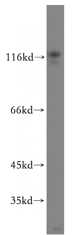 Jurkat cells were subjected to SDS PAGE followed by western blot with Catalog No:111859(ITGA4 antibody) at dilution of 1:3000