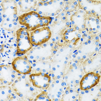 Immunohistochemistry - SLC5A1 Polyclonal Antibody 