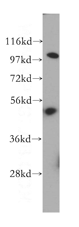 HeLa cells were subjected to SDS PAGE followed by western blot with Catalog No:113458(OAS1 antibody) at dilution of 1:500