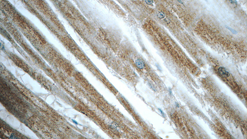 Immunohistochemistry of paraffin-embedded human heart tissue slide using Catalog No:108872(Caspase 12 Antibody) at dilution of 1:50 (under 40x lens)