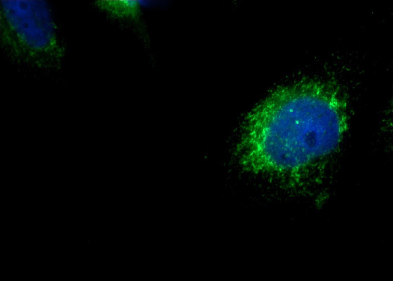 Immunofluorescent analysis of MDCK cells using Catalog No:115028(SDCCAG8 Antibody) at dilution of 1:50 and Alexa Fluor 488-congugated AffiniPure Goat Anti-Rabbit IgG(H+L)