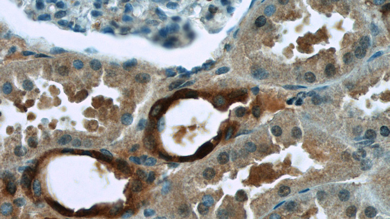 Immunohistochemistry of paraffin-embedded human kidney tissue slide using Catalog No:115981(TAF15 Antibody) at dilution of 1:50 (under 40x lens)