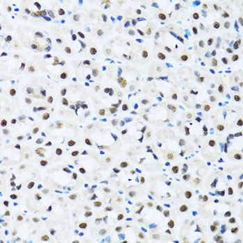 Immunohistochemistry - CCAR2 Polyclonal Antibody 