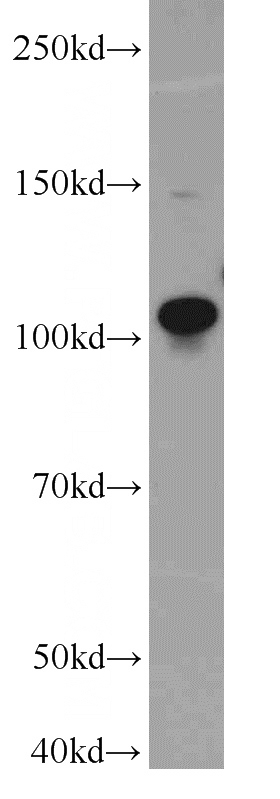 K-562 cells were subjected to SDS PAGE followed by western blot with Catalog No:116249(TOP3A antibody) at dilution of 1:1000